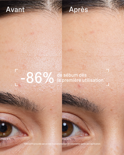 Masque stick Peau Nette