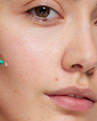 Tratamiento Flash Imperfecciones